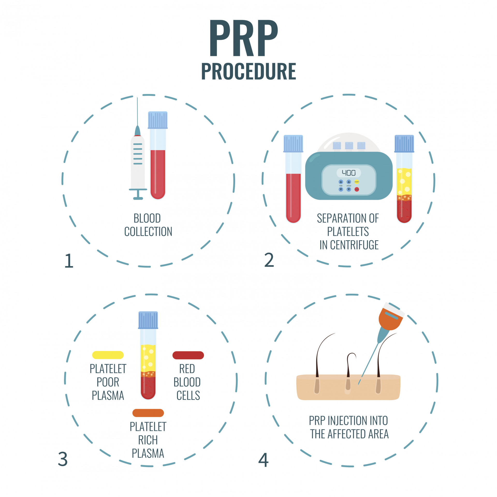 PRP Hair Treatment in Istanbul