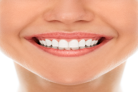 Hollywood Smile