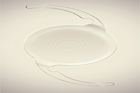 Trifocal Lens