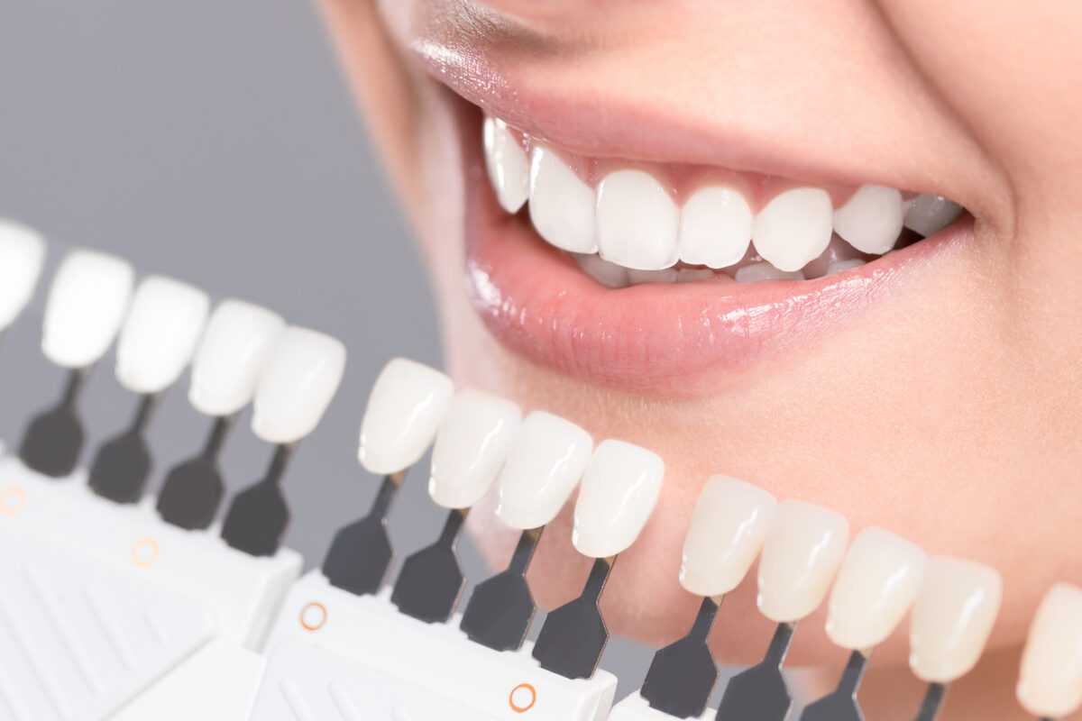 smilemakeover2 scaled