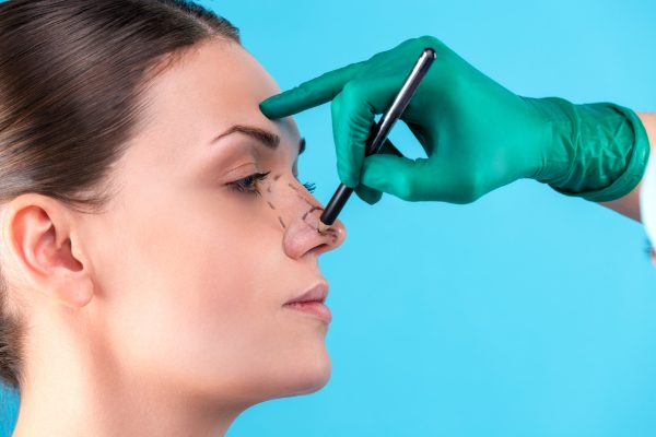 rhinoplasty turkey 3 rhinoplasty turkey 3