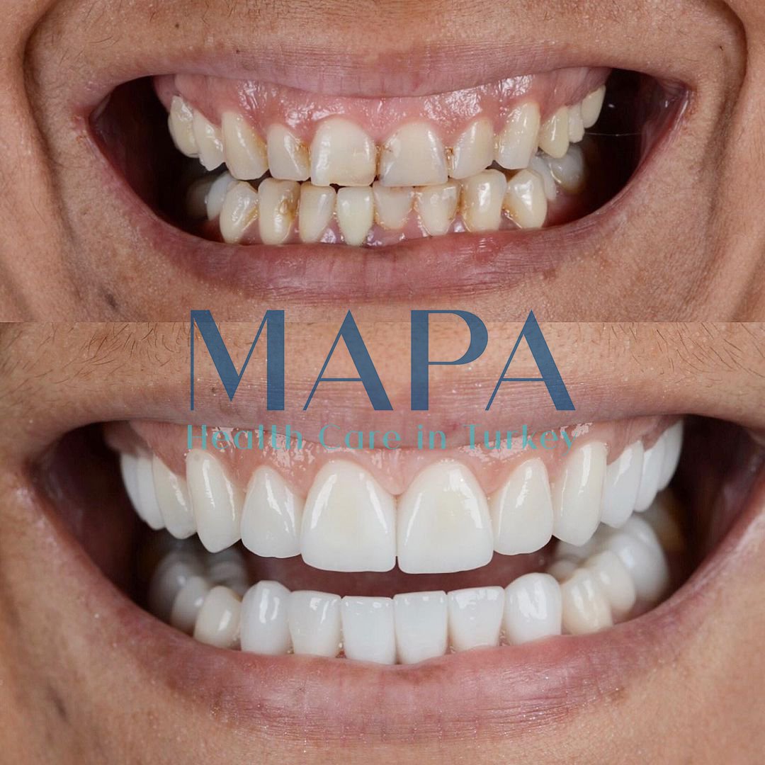 mapagoz2
