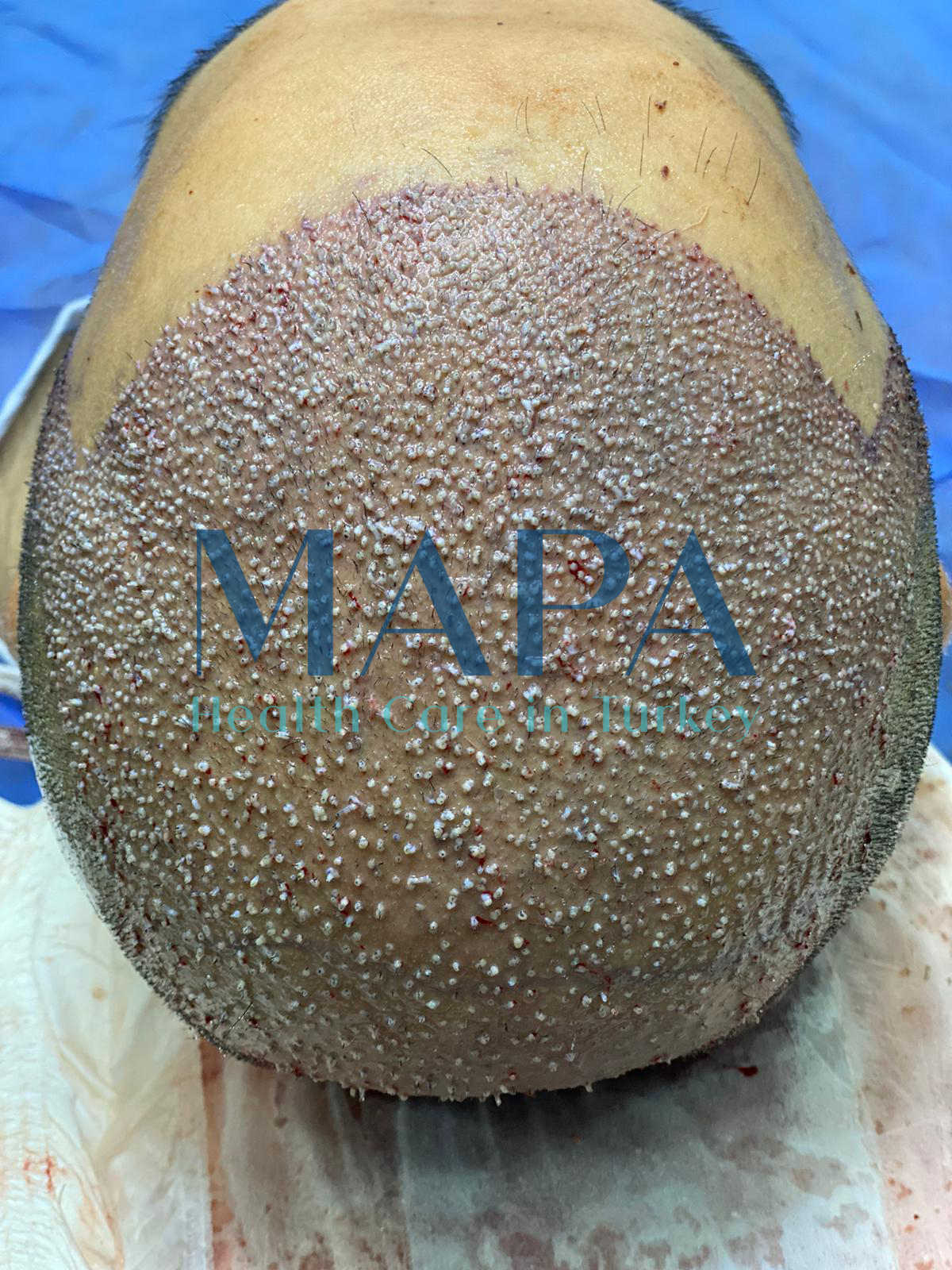 Resultaat van de behandeling