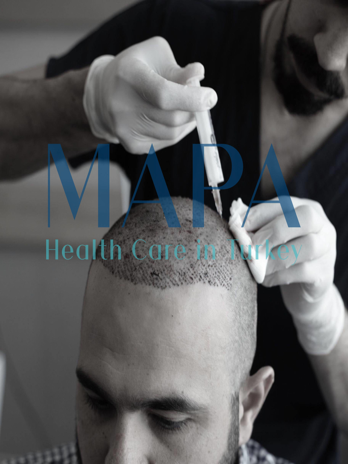 Resultaat van de behandeling